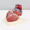 Reducing Risk of Heart Attack and Stroke with Tirzepatide