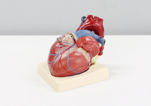 Reducing Risk of Heart Attack and Stroke with Tirzepatide